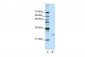 POP4 antibody - C-terminal region